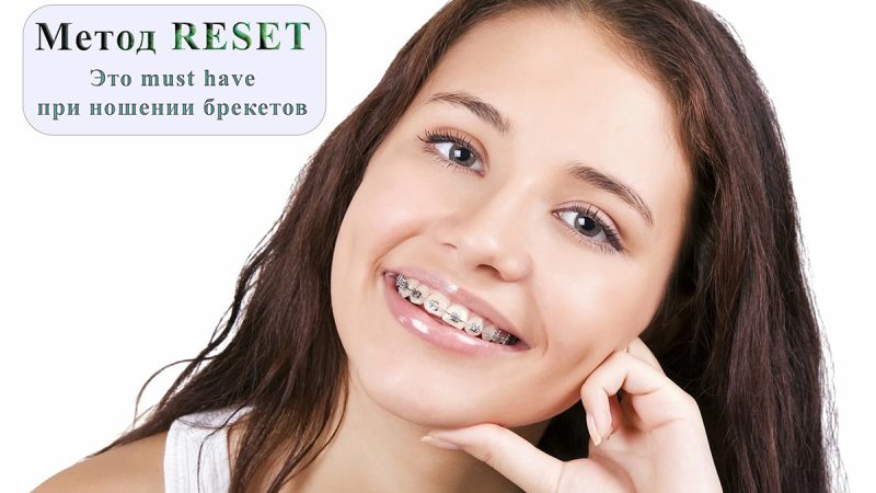 Брекеты ставят ребёнку